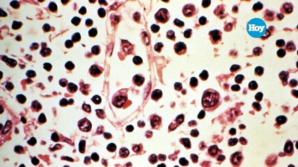 La OMS sitúa en seis los casos de hantavirus en el Hondius y mantiene abierta la pesquisa sobre el brote: puntos clave