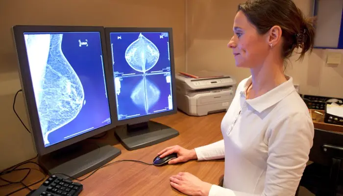 Alta mortalidad por cáncer de mama expone una deuda de detección temprana en República Dominicana